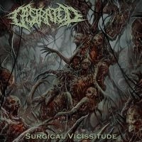 Castrated - Surgical Vicissitude i gruppen CD / Hårdrock hos Bengans Skivbutik AB (5555842)